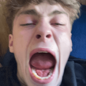 derkmeger