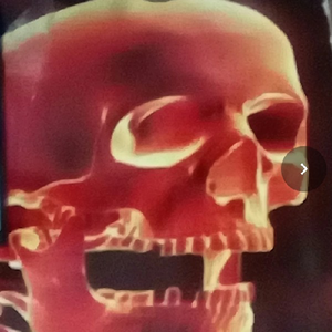 skellyrock