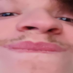 Axdm_