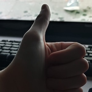 Aleklar