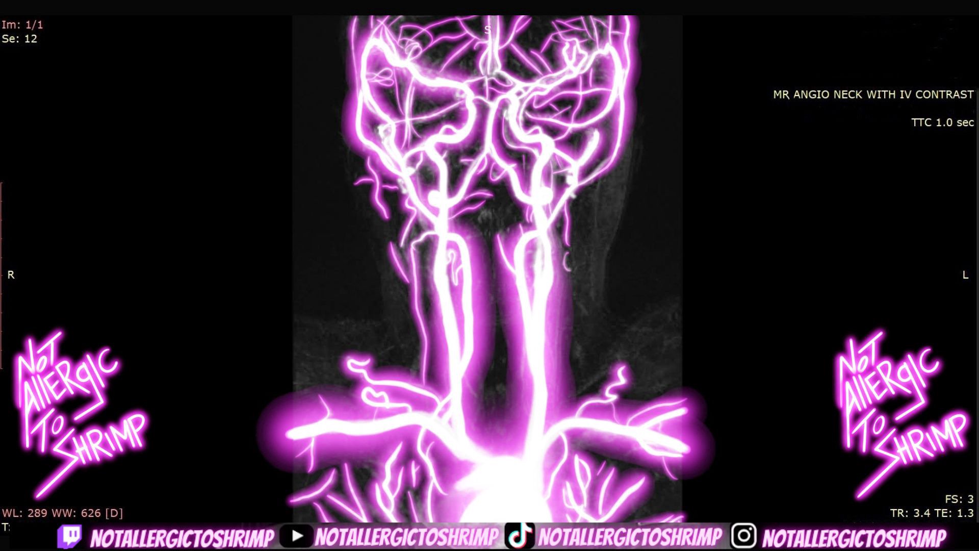 NotAllergicToShrimp Offline Background