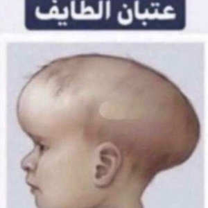 gc_mmmm